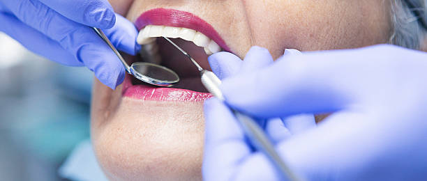Best Emergency Root Canal Treatment in Lake Shore, WA